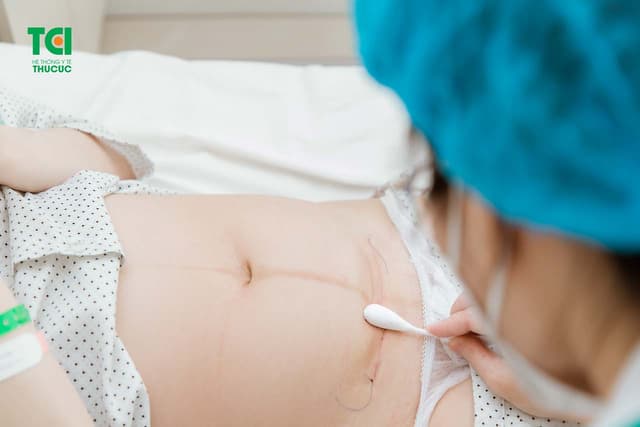 Thai phụ mổ đẻ dọc hay ngang tốt hơn? Khi nào đẻ mổ?