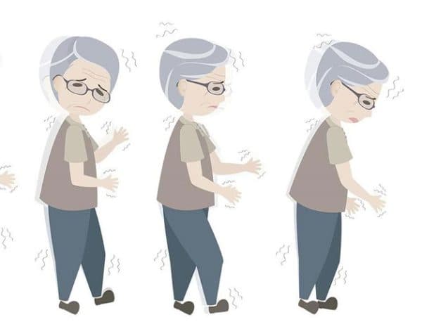 Bệnh parkinson người già
