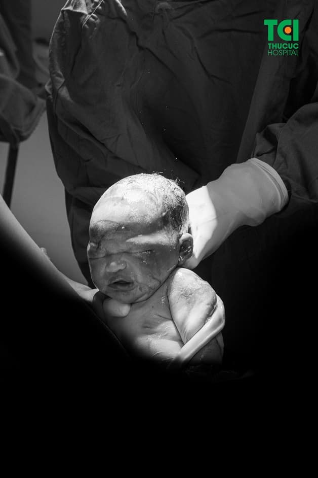 Đẻ thường là phương pháp sinh con tự nhiên, nguyên thủy nhất