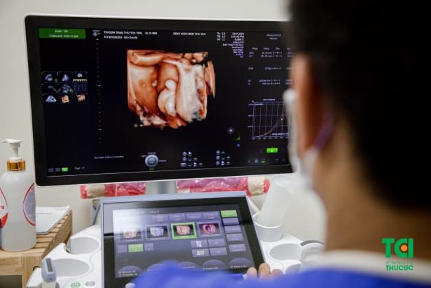 siêu âm khám thai