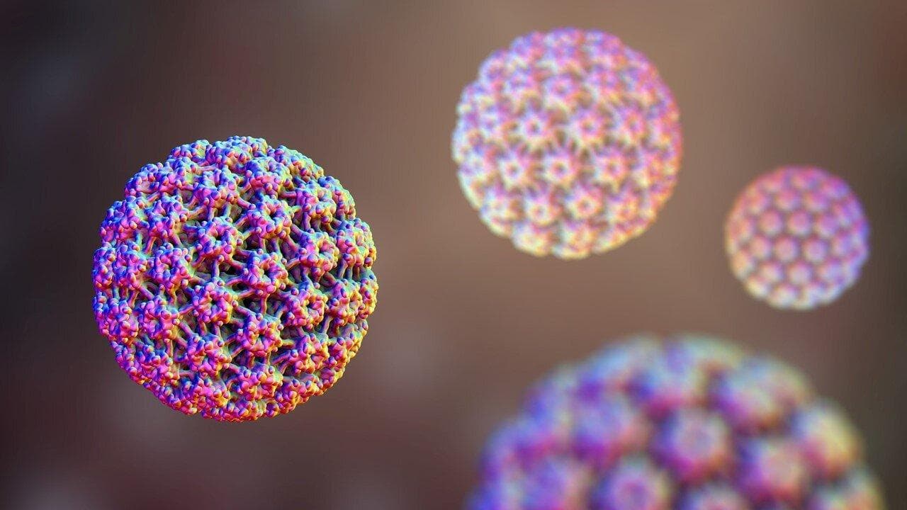 Sùi mào gà là bệnh do virus gây u nhú ở người - virus HPV ( Human Papillomavirus) gây ra