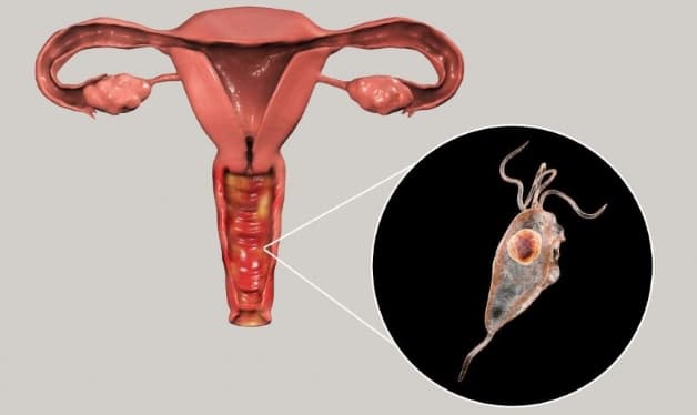 tìm hiểu chung về tạp khuẩn