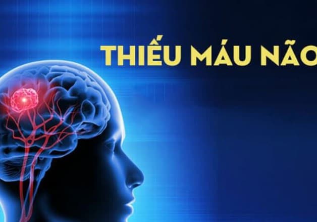 Hệ quả có thể dẫn đến thiếu máu não