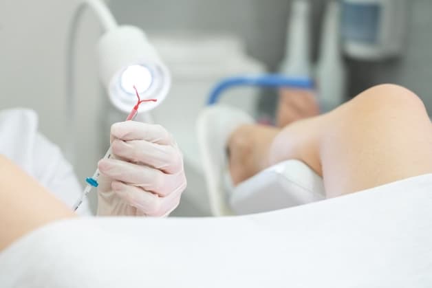 thời điểm đặt vòng tránh thai như thế nào