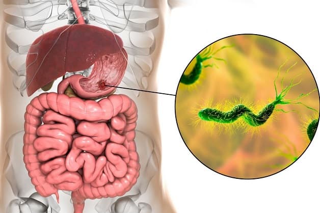 Viêm dạ dày tá tràng có nguy hiểm không?