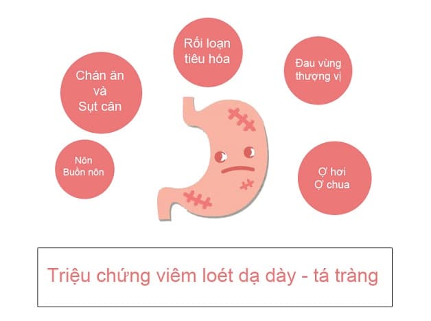 Viêm dạ dày triệu chứng khá đa dạng