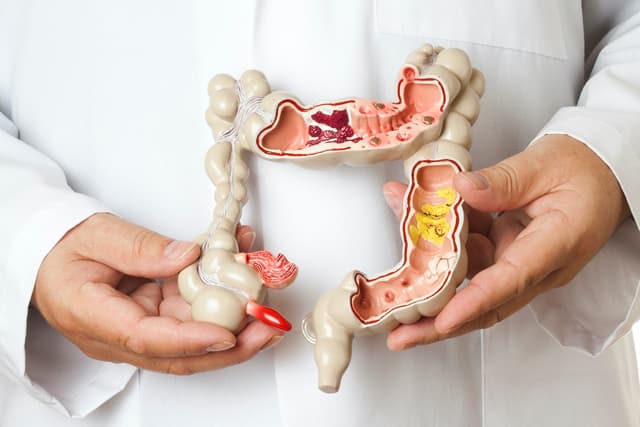 Lý giải viêm đại tràng mãn tính có nguy hiểm không?