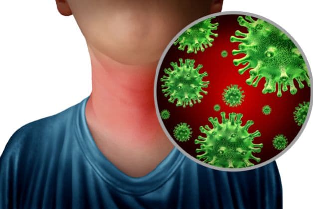 Khái niệm bệnh viêm họng cấp ở trẻ