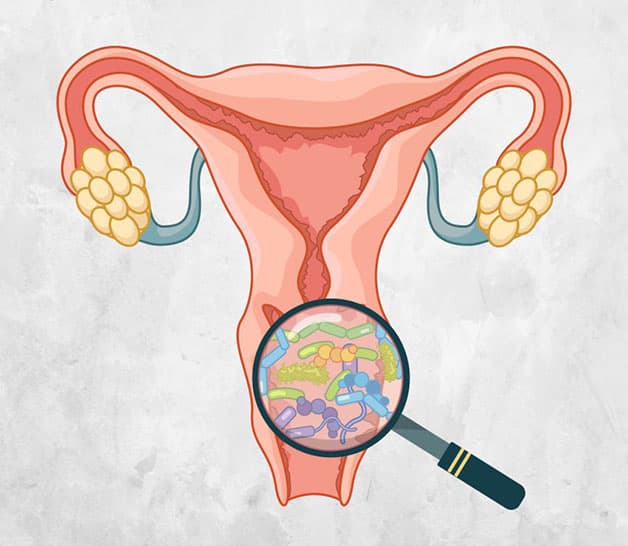 Viêm nhiễm phụ khoa là bệnh lý phổ biến nhất, có thể tấn công mọi đối tượng phụ nữ ở các độ tuổi khác nhau