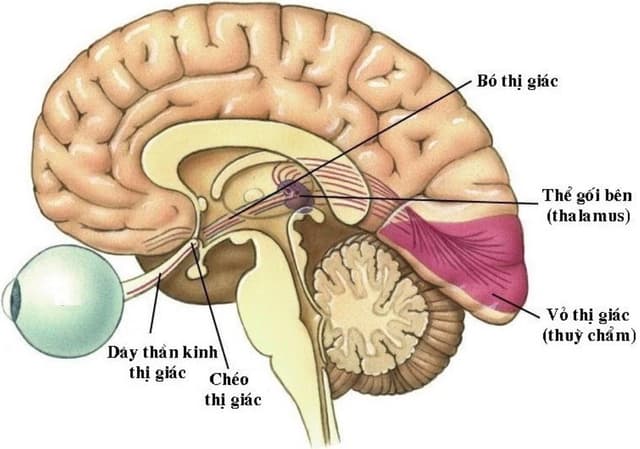 Những điều cần biết về bệnh viêm thị thần kinh cấp