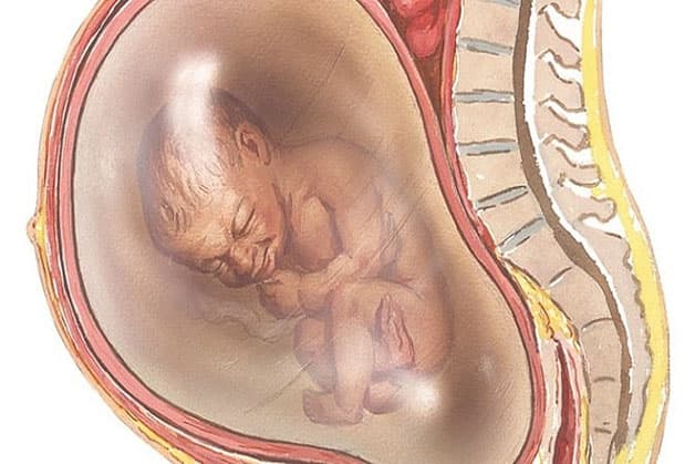 Vỡ ối sớm là tình huống rất nguy hiểm với các mẹ bầu, là tiền đề của việc sinh non