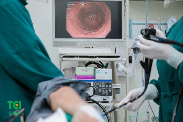 Nội soi đường mũi là phương pháp gây ít khó chịu nhất cho người bệnh