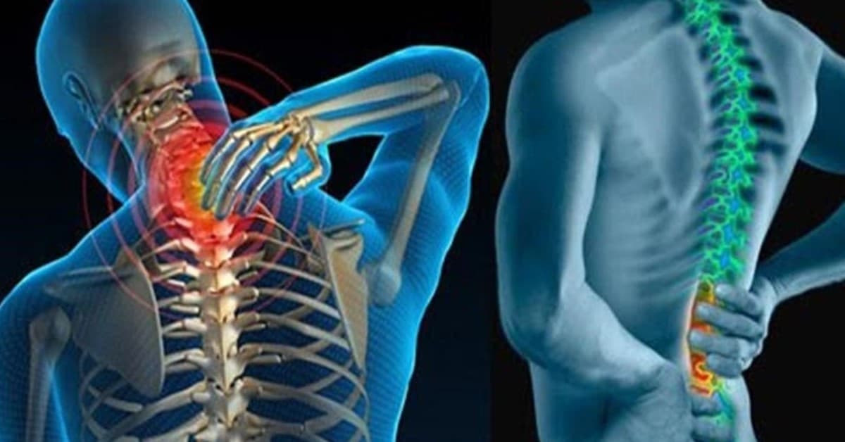 Những vấn đề cần quan tâm về thoái hóa cột sống cổ và thắt lưng