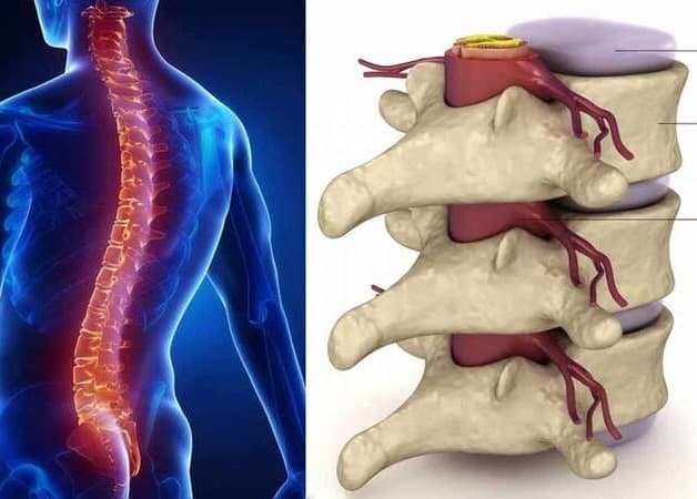Các đốt sống lưng là nơi chịu trọng tải rất lớn từ cơ thể