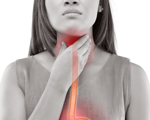 Người mắc chứng trào ngược dạ dày thực quản thường xuyên bị khó ngủ về đêm