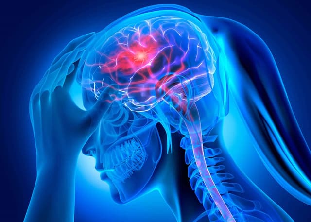 Bệnh lý mạch máu não: Phân loại và triệu chứng