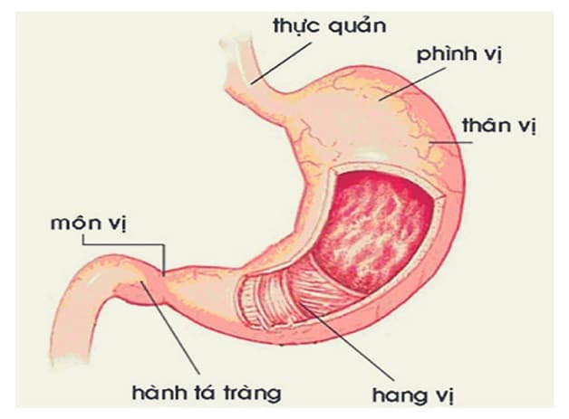 Bệnh viêm loét dạ dày hành tá tràng thường gặp ở hệ tiêu hóa