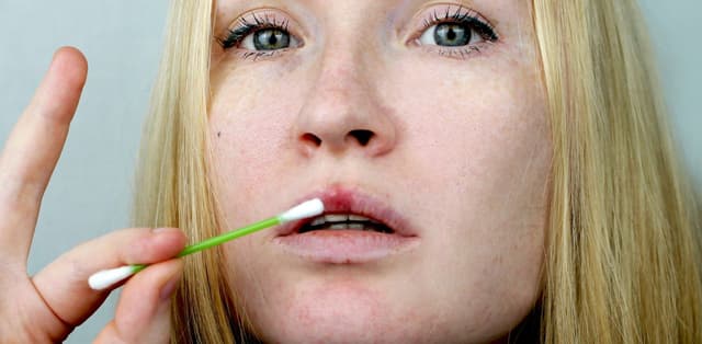 Các dấu hiệu bệnh giang mai thường gặp nhất