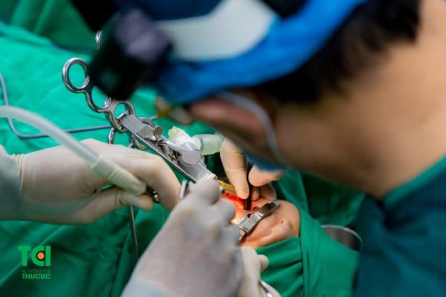 Cắt Amidan cho trẻ, đâu là phương pháp tốt nhất