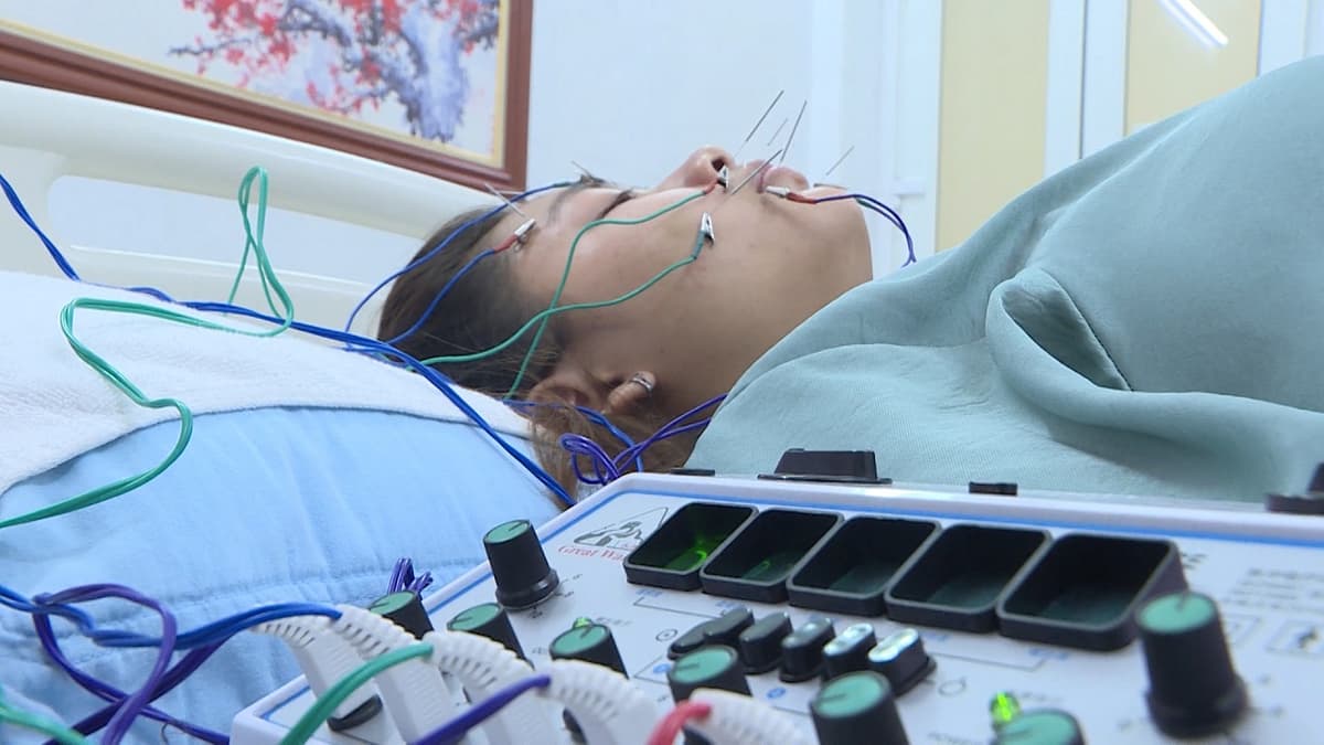 Viêm dây thần kinh 7 nguyên nhân và cách phòng tránh 