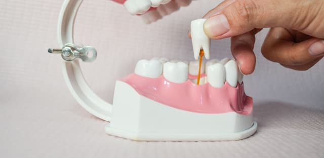 Chăm sóc sau nhổ răng hàm nhanh lành thương