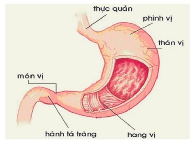 Viêm loét hành tá tràng là bệnh thường gặp ở hệ tiêu hóa