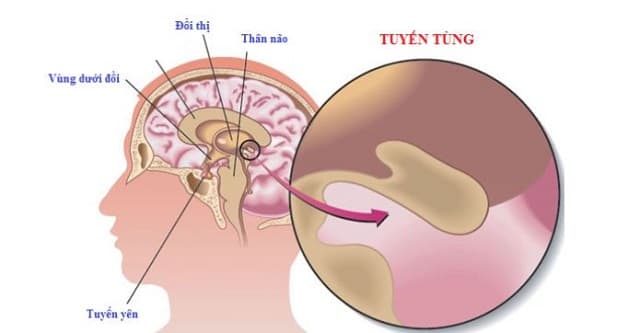cơ chế đau đầu vì mất ngủ lâu ngày