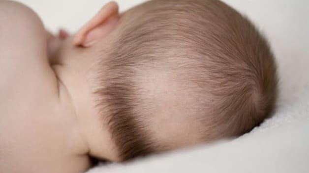 dấu hiệu trẻ còi xương