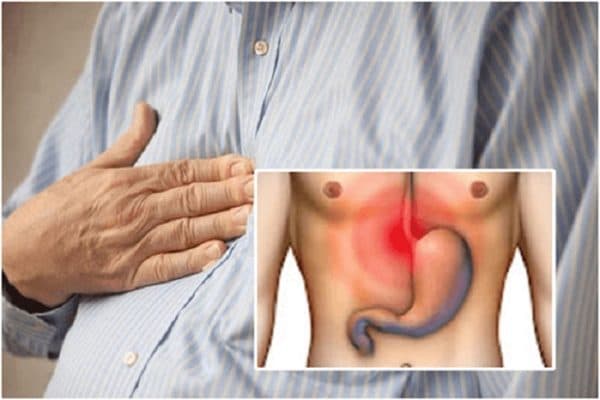 Thượng vị dạ dày là gì?