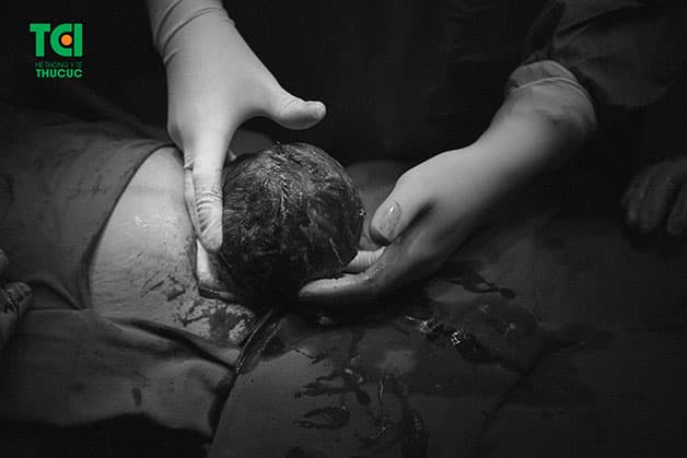 Bác sĩ thường thực hiện vết rạch ngang khi mổ đẻ, chiều dài vết mổ không quá lớn, đủ để đưa em bé ra ngoài