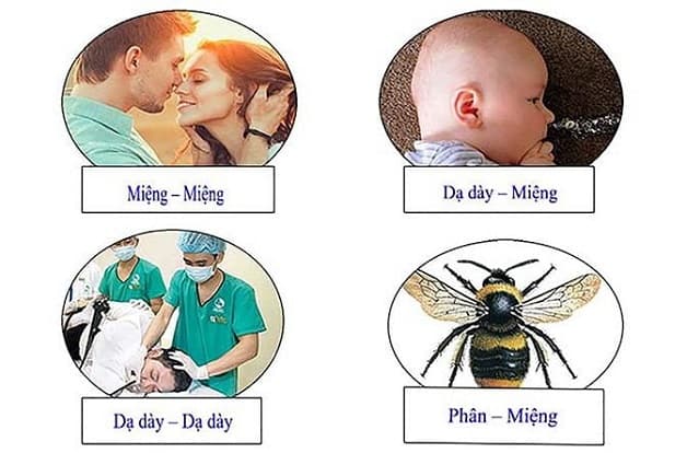 Viêm dạ dày có thể lây qua nhiều con đường khác nhau