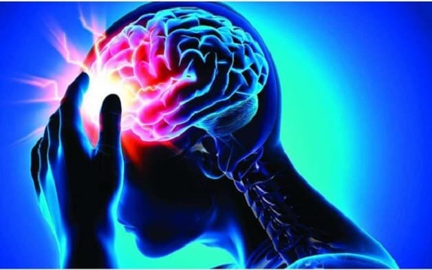 hay bị đau nửa đầu coi chừng tai biến mạch máu não. 