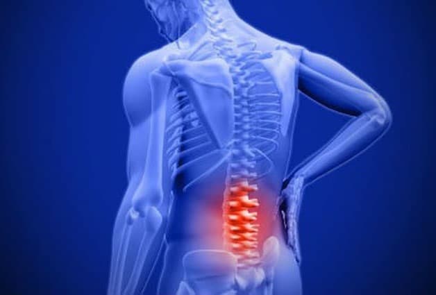 Thoái hóa đốt sống lưng