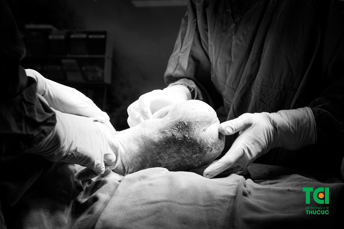 Liên cầu khuẩn nhóm B và thai ngôi ngược: Mẹ bầu nên làm gì?