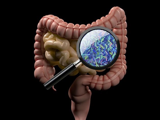 Các nguyên nhân viêm đại tràng