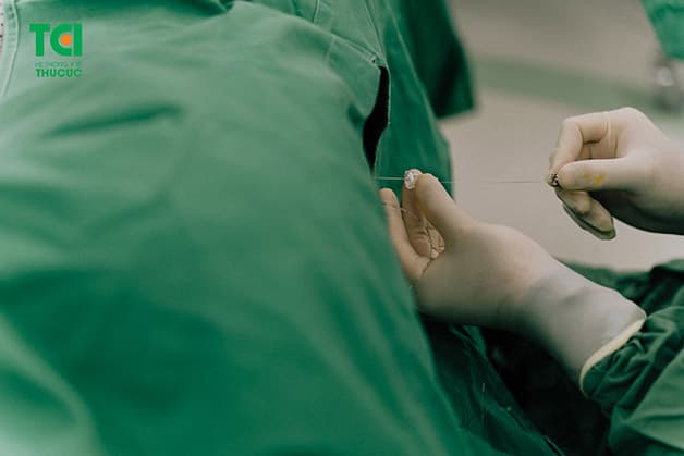 Thai phụ được tiến hành gây tê tủy sống trước khi bước vào ca sinh