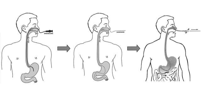 Nội soi đường mũi: Những thông tin bạn cần biết