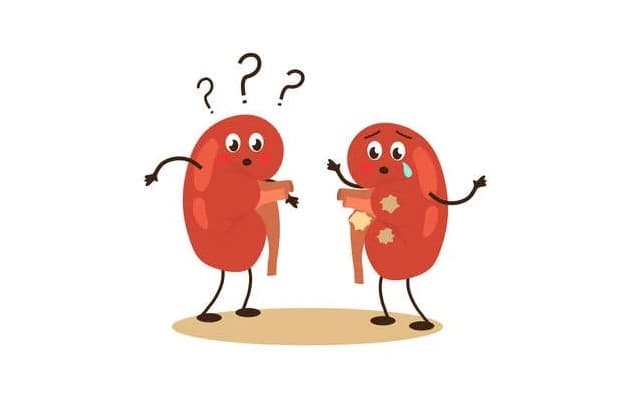 Giải đáp: Khi nào cần tán sỏi thận công nghệ cao