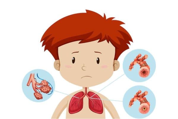 Một số bệnh lý tại phổi hoặc ngoài phổi là nguyên nhân khiến trẻ bị suy hô hấp