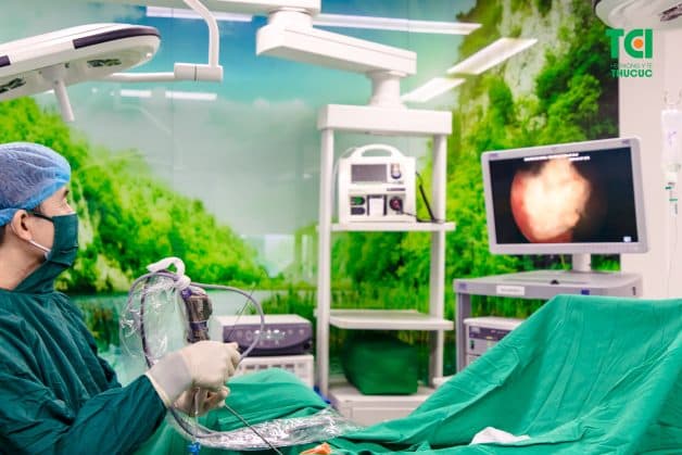 Các cách xử lý sỏi bàng quang hiệu quả