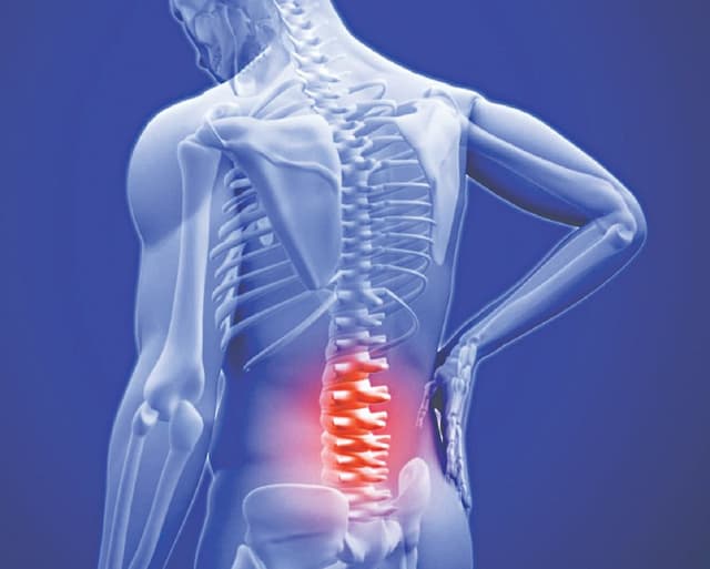 Thoái hóa cột sống thắt lưng hay gặp ở đối tượng nào?