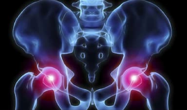 Viêm khớp cùng chậu có điều trị được không?