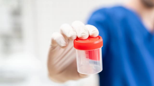 Cách lấy mẫu xét nghiệm tinh dịch đồ chính xác nhất