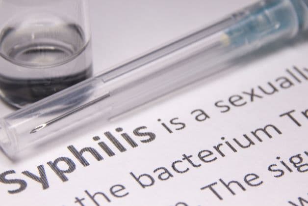 Các triệu chứng của bệnh giang mai thường gặp
