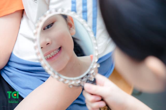 Cao răng khổng lồ và cách phòng tránh