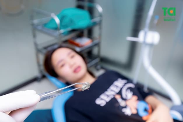 chăm sóc nướu răng