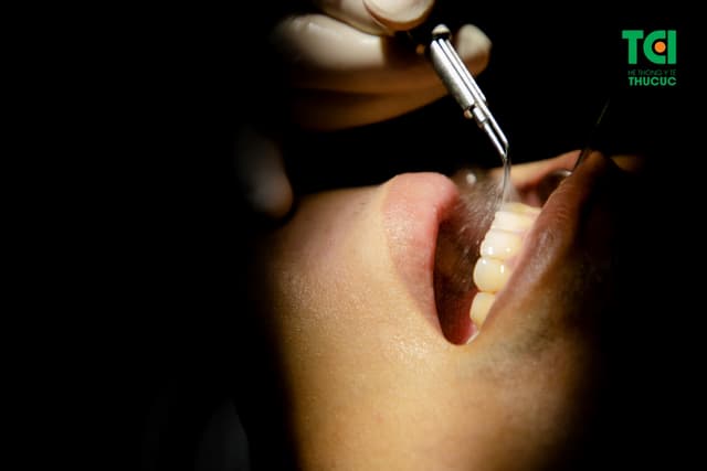 Chăm sóc răng bị ê buốt và những điều cần biết