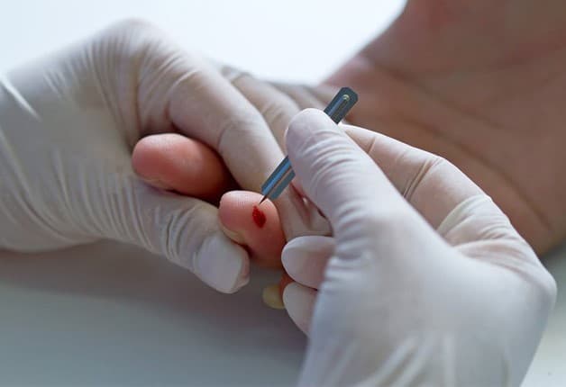 lưu ý cách sơ cứu người bị tai biến mạch máu não - không trích, nặn máu tay, dái tai người bệnh