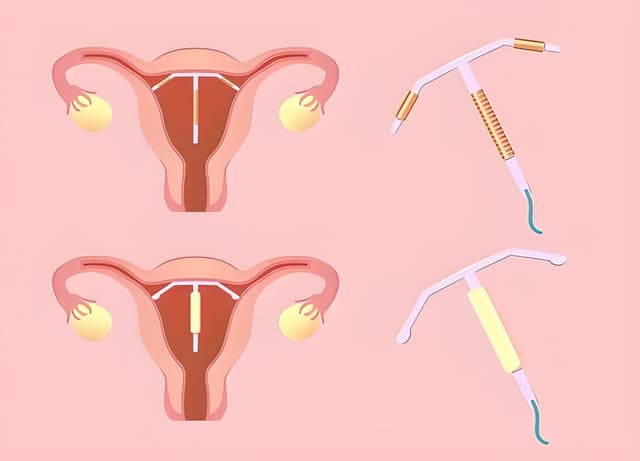 Đặt vòng có tăng cân không? Tác dụng phụ của đặt vòng là gì?