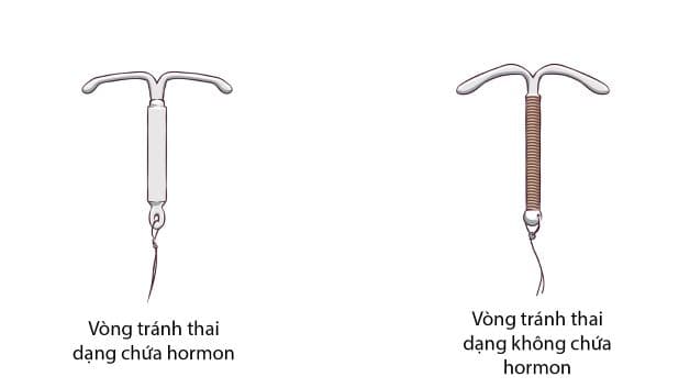 Cả 2 loại vòng tránh thai đều có tác dụng cản trở quá trình trứng và tinh trùng gặp nhau
